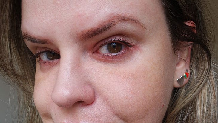 Protetores solares para melasma: conheça 8 boas opções